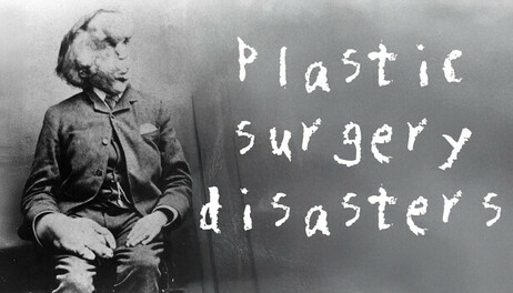 Купить Rising Star 2 - Plastic Surgery Disasters