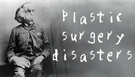 Купить Rising Star 2 - Plastic Surgery Disasters